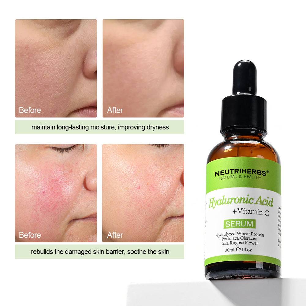 Hyaluronic Acid Serum For Oily Skin