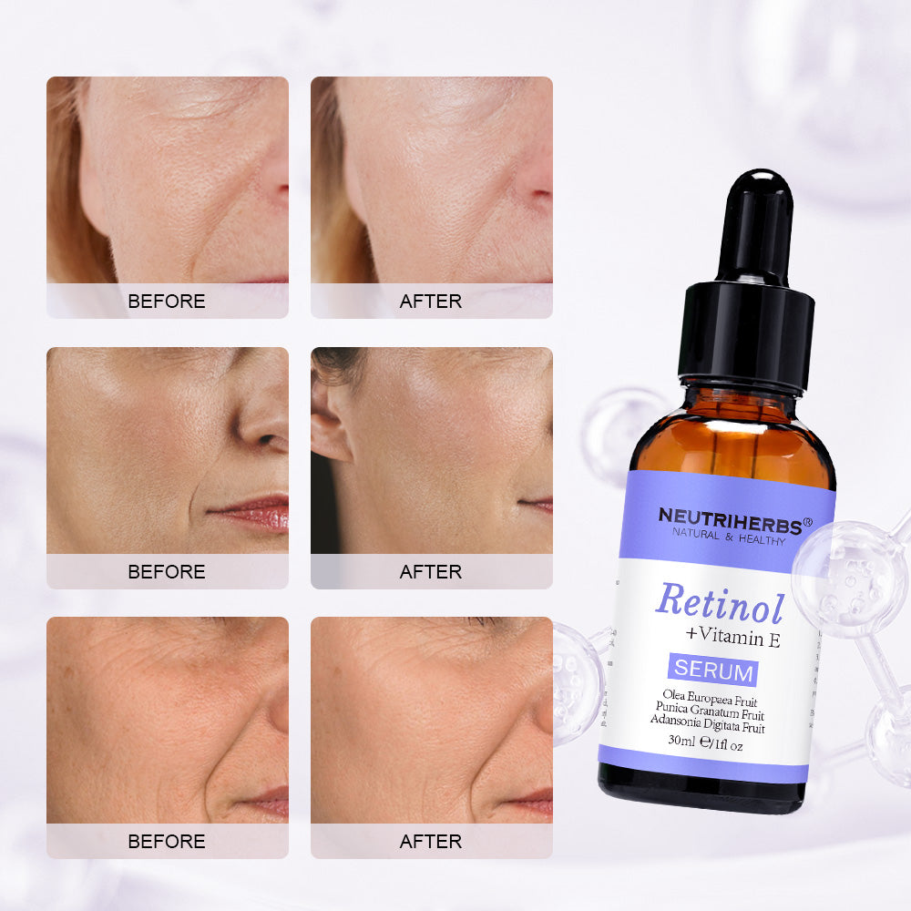 Retinol Serum Helps Defend Against Signs Of Aging