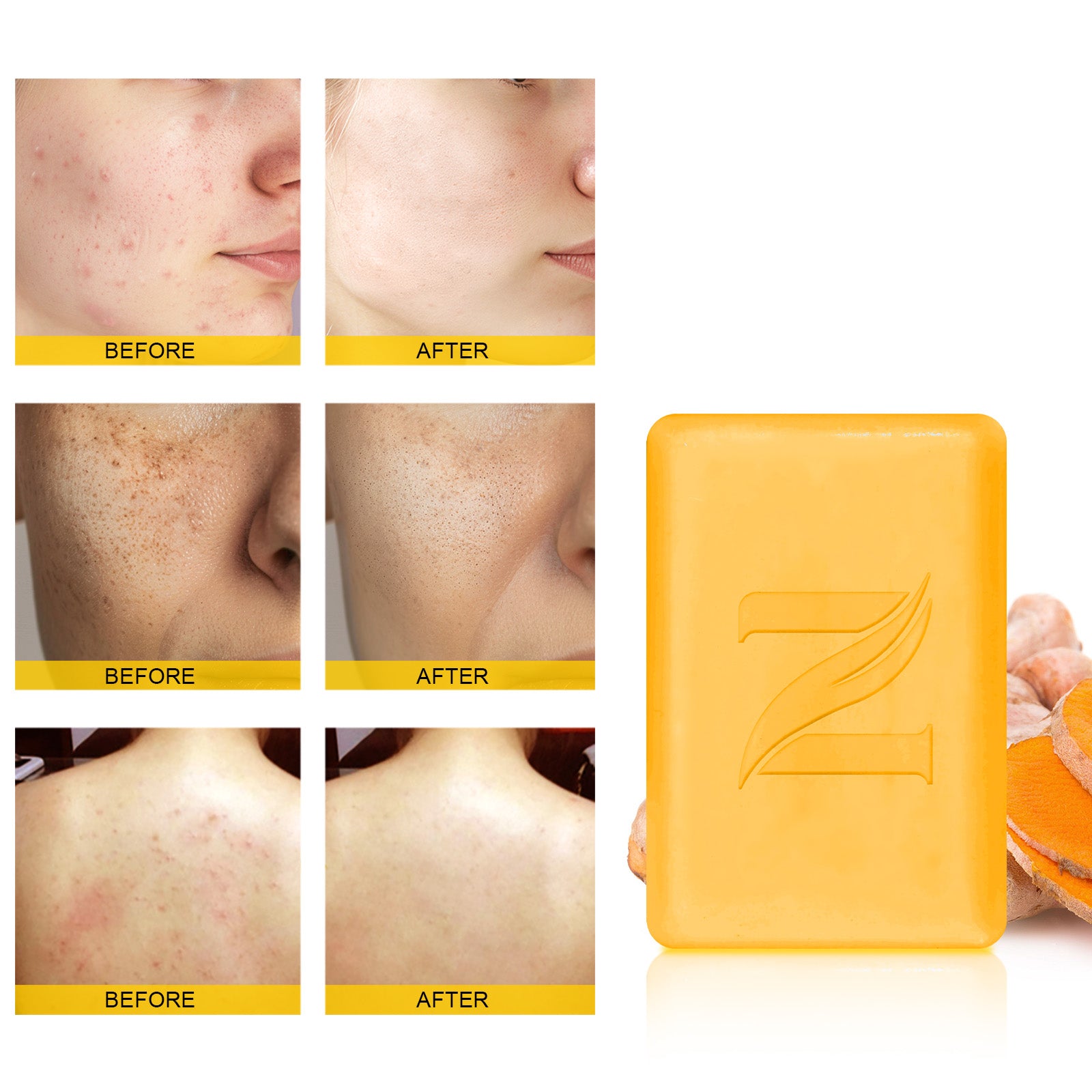 Best Vitamin C Turmeric Soap For Black Skin Even Skin Tone