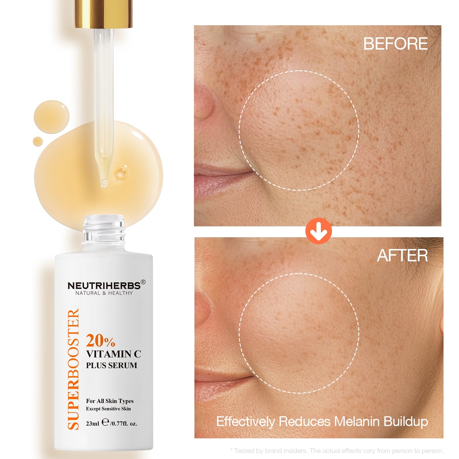 Super Booster Vitamin C Plus Brightening Serum (20% VC)